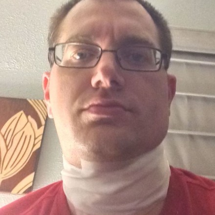 Me, looking totally thrilled the day after having a salivary gland removed from my mouth. Notice the stylish gauze wrap around my neck.